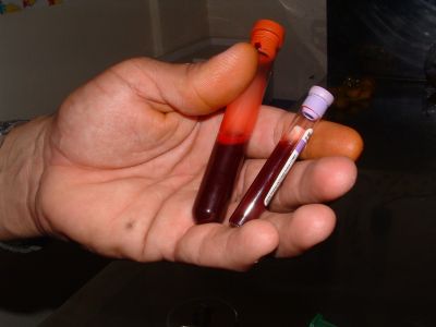Vérvétel vér