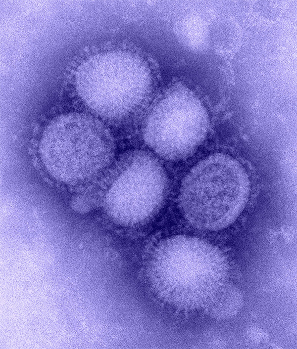 H1N1 vírus H1N1